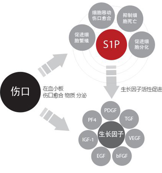 s1p